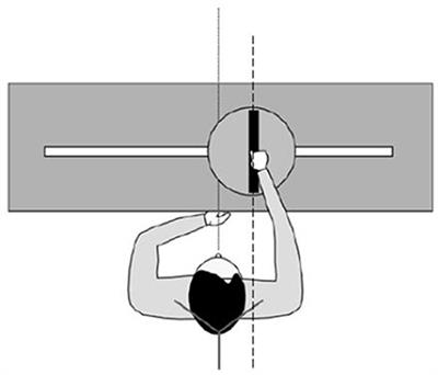 Representation of Body Orientation in Vestibular-Defective Patients Before and After Unilateral Vestibular Loss